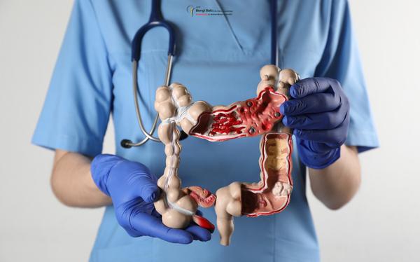 Antalya Kolon Kanseri Ameliyatı ve Tedavisi 