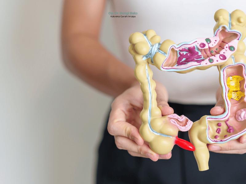 Kolon ve Rektum Bağırsak Hastalıkları