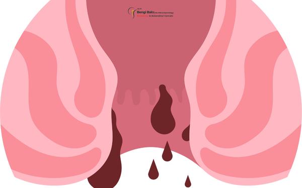 Makatta Kanama Nedenleri ve Hangi Durumlar Tehlikelidir?
